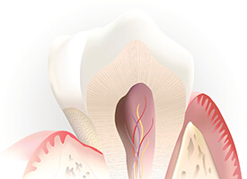 Root canals