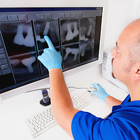 Dentist looking at teeth x-rays
